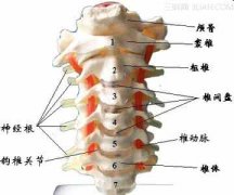 颈椎膨出引起头痛