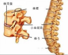 腰间盘突出腰椎狭窄