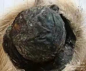 请欣赏寸元散妙治骨坏死传奇.传承国医文化 军旅郎中.2023.10.20